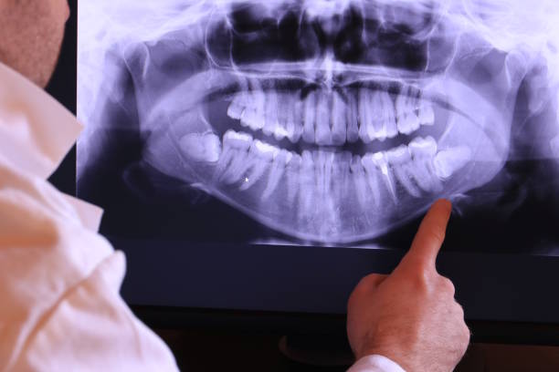 Best Emergency Dental Services for Seniors in South Hill, NY